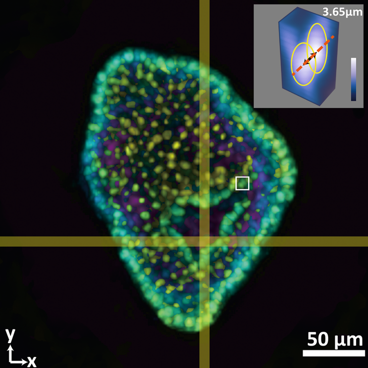 Jia - Colon Organoid with cell inset