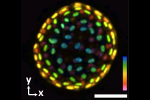 Jia - Colon Organoid 3D Image